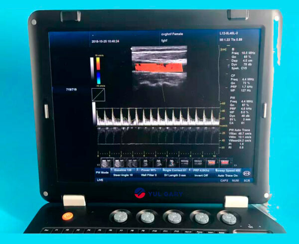 128 Item 3D Medical THI Ultrasound Machine For Sale With Convex Probe YG1011 - Image 3
